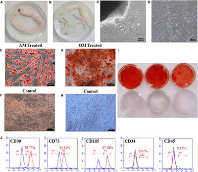 Human Umbilical Cord Mesenchymal Stem Cell Differentiation Into Odontoblast-Like Cells and Endothelial Cells: A Potential Cell Source for Dental Pulp Tissue Engineering